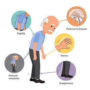 بیماری پارکینسون